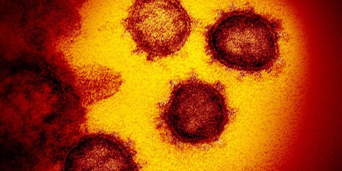 Os picos na borda externa das partículas do vírus dão aos nomes dos coronavírus, em forma de coroa (Niaid-RML/Fotos Públicas)